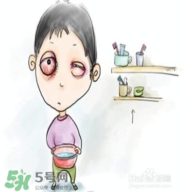 紅眼病是怎么引起的？紅眼病怎么產(chǎn)生的