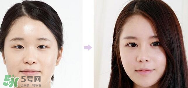 哪些人需要開眼角？需要開眼角的眼睛圖片