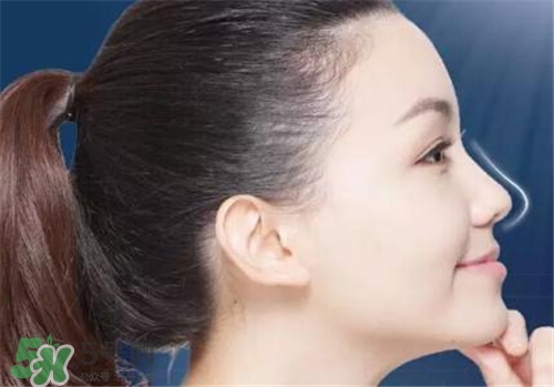 隆鼻會拉近眼距嗎？隆鼻會改變眼睛嗎？