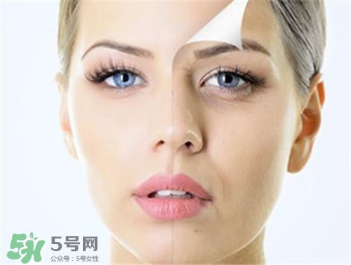 玻尿酸除皺有效果嗎？玻尿酸除皺效果怎么樣？