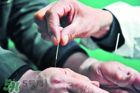 沒(méi)病可以針灸嗎？沒(méi)病可以扎針嗎？