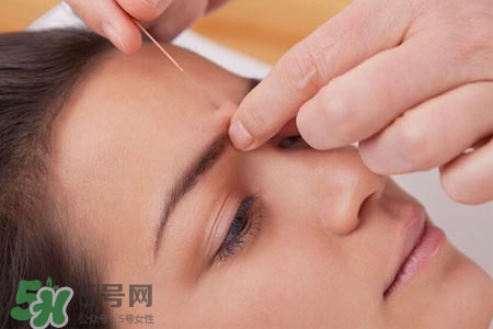 沒(méi)病可以針灸嗎？沒(méi)病可以扎針嗎？