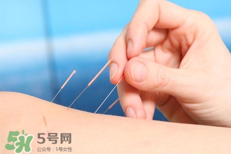 沒(méi)病可以針灸嗎？沒(méi)病可以扎針嗎？