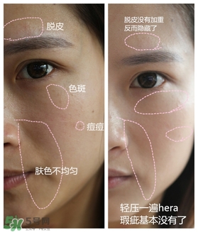 赫拉氣墊用了悶痘嗎？赫拉氣墊悶痘怎么辦？