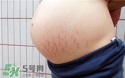 妊娠紋幾個(gè)月開(kāi)始出現(xiàn)？妊娠紋能消除掉嗎？