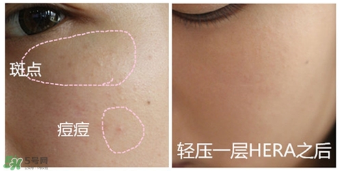 赫拉氣墊用了悶痘嗎？赫拉氣墊悶痘怎么辦？