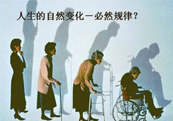 哪些人容易得骨質(zhì)疏松癥？骨質(zhì)疏松的高發(fā)人群有哪些？