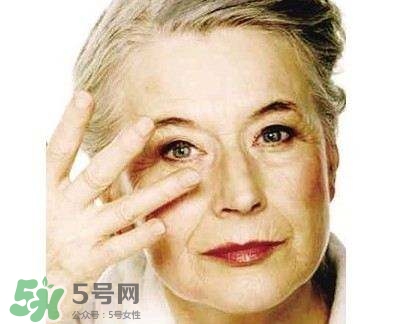 老年斑是怎么形成的？老年斑的形成原因