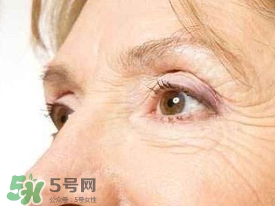 老年斑是怎么形成的？老年斑的形成原因