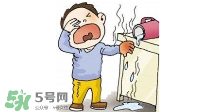 燙傷可以用牙膏嗎？燙傷用牙膏管用嗎？