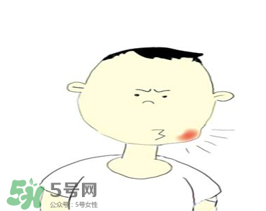 嘴角起泡是什么原因？嘴角起泡怎么辦？