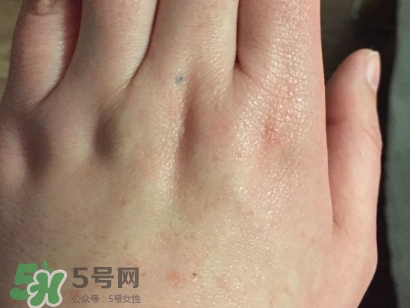 薇諾娜適合什么皮膚？薇諾娜適合敏感肌嗎？