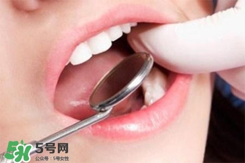 口腔異味是怎么回事？口腔異味怎么清除？