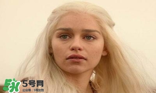 臉色發(fā)黃是什么原因？臉色發(fā)黃吃什么調(diào)理更好？