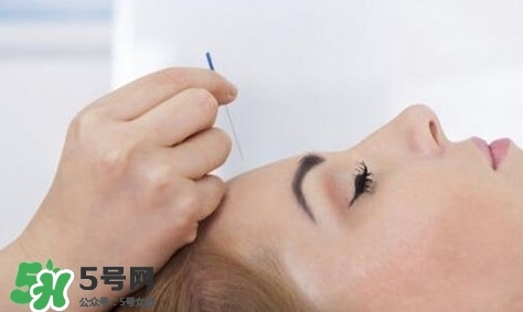 叢集性頭痛會(huì)死人嗎？叢集性頭痛的特點(diǎn)
