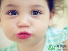 孕期可以激光祛斑嗎？懷孕了能做激光祛斑嗎？