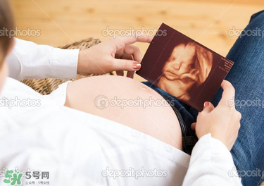 橄欖油真的可以預(yù)防妊娠紋嗎？橄欖油真的可以去妊娠紋嗎？