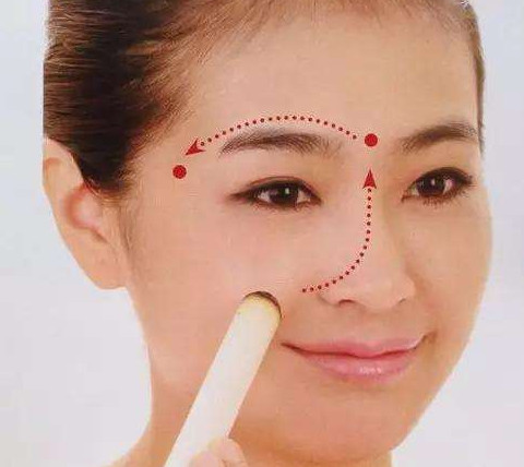 艾灸可以去黑眼圈嗎？艾灸可不可以去黑眼圈
