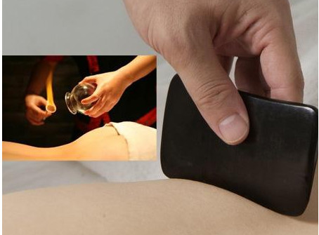 刮痧之后可以拔罐嗎？刮痧之后可不可以拔罐