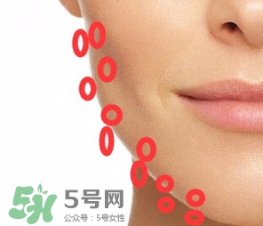 nuface美容儀有效嗎？nuface美容儀副作用？