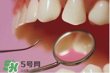 牙周炎傳染嗎？牙周炎會(huì)不會(huì)傳染