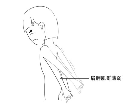 高低肩怎么糾正？高低肩的危害
