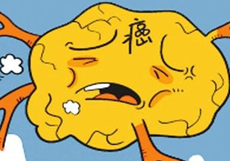 胃癌是怎么引起的？胃癌的早起癥狀