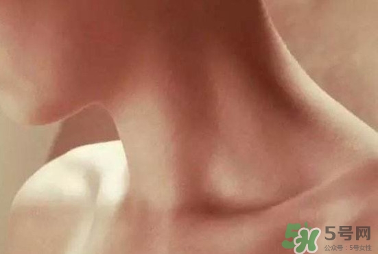 頸椎老化是什么??？頸椎老化的癥狀