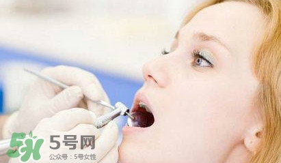 牙齒松動(dòng)能自己恢復(fù)嗎？牙齒松動(dòng)會(huì)自己恢復(fù)嗎