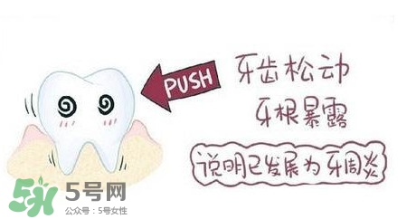 牙齒松動(dòng)能自己恢復(fù)嗎？牙齒松動(dòng)會(huì)自己恢復(fù)嗎