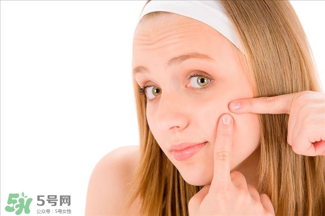 得了痤瘡飲食注意什么？有痤瘡吃東西注意什么