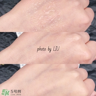 美帕b5噴霧有激素嗎？美帕噴霧副作用