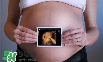 四維彩超能看出男女嗎？四維彩超能看清手指嗎？