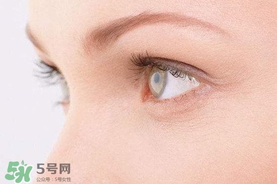 眼睛布滿血絲怎么回事？眼睛布滿血絲怎么辦