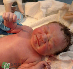 新生兒手握避孕環(huán)出生是怎么回事？出生后健康嗎？