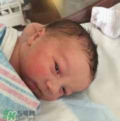 新生兒手握避孕環(huán)出生是怎么回事？出生后健康嗎？