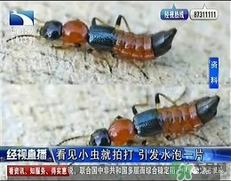 隱翅蟲有毒嗎？隱翅蟲會(huì)毀容嗎？