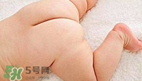 尿布疹怎么辦？寶寶尿布疹擦什么藥好？