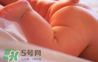 寶寶尿布疹可以擦紅霉素軟膏嗎？紅霉素軟膏對尿布疹有效嗎？
