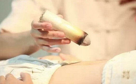 刮痧后可以艾灸嗎？刮痧后注意事項(xiàng)
