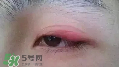 長期用假睫毛雙眼皮貼對眼睛有什么傷害？