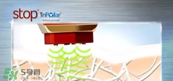 tripollar stop怎么樣？tripollar pose好用嗎