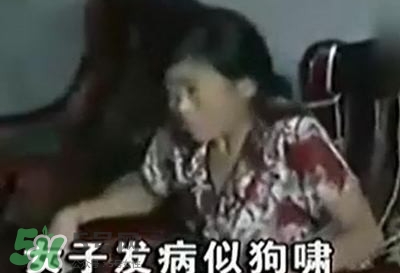 狂犬病能治好嗎？狂犬病的早期癥狀