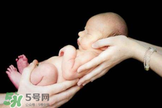 寶寶臍帶掉了要緊嗎？寶寶臍帶掉了出血了怎么辦？