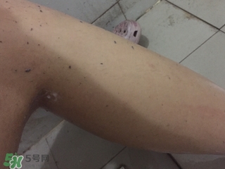 shills舒兒絲去角質(zhì)雪泡怎么用？shills舒兒絲去角質(zhì)雪泡用法