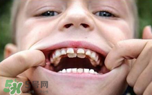 兒童換牙可以吃鈣片嗎?兒童換牙吃什么好？