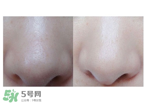 碧柔鼻貼白色和黑色哪個(gè)好？碧柔鼻貼黑白區(qū)別