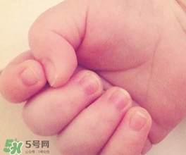 寶寶指甲凹凸不平是什么原因？寶寶指甲凹凸不平正常嗎？