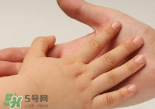 寶寶指甲凹凸不平是什么原因？寶寶指甲凹凸不平正常嗎？