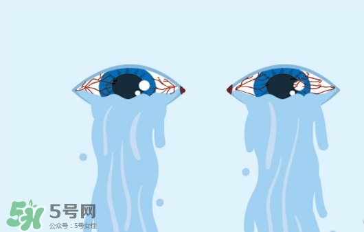 眼藥水可以兩個(gè)人用嗎？眼藥水可以共用嗎？